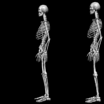 skeleton-21-june.gif